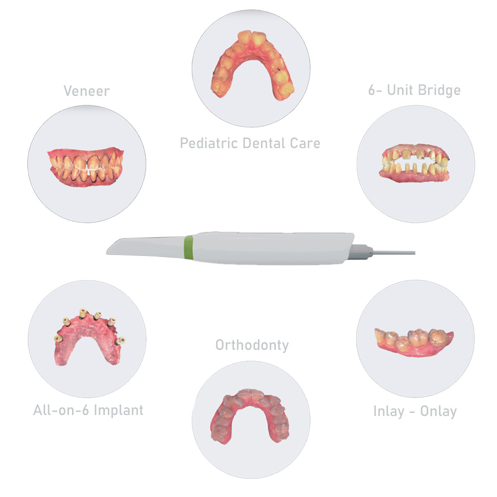 Interoral Scanner